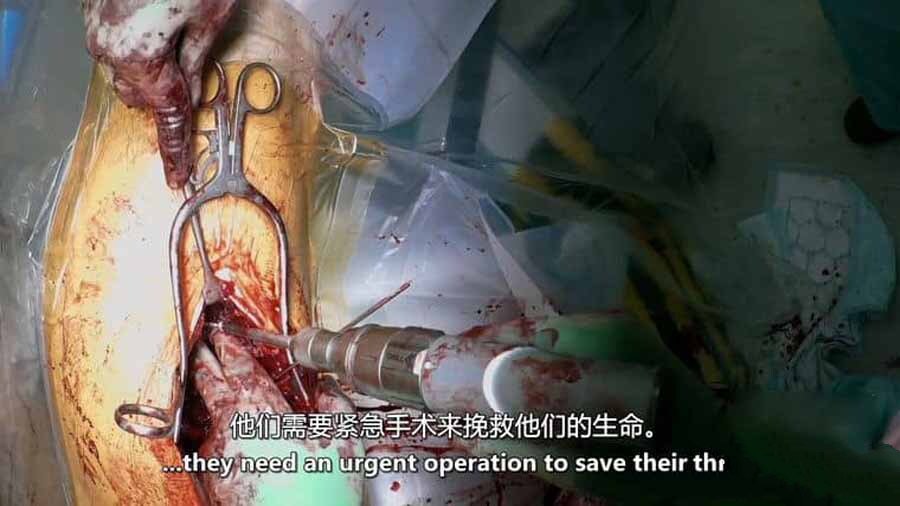 《外科医生：生命边缘 Surgeons: At the Edge of Life 2023》[1080P/MKV][第5季全6集 英语中英双字 官方纯净版][8.64G][百度网盘]插图